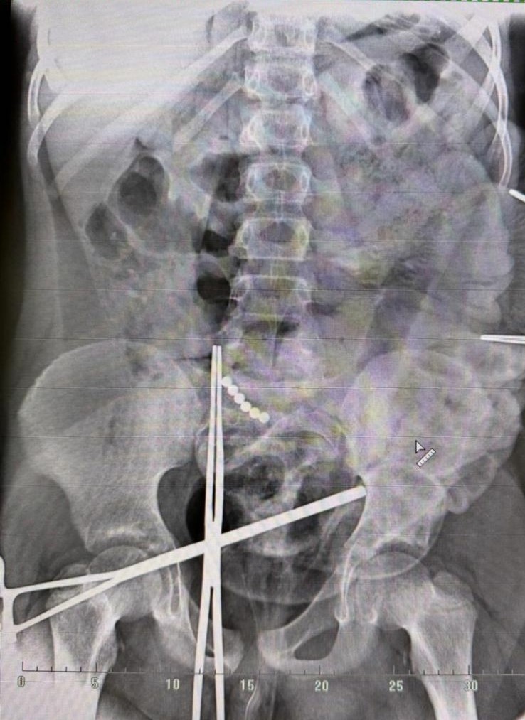 диагностика магниты.jpg