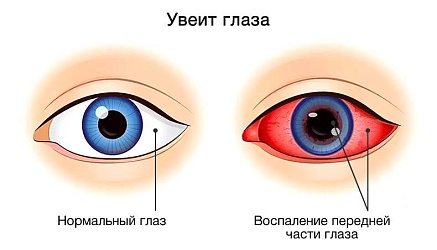 Клинический случай, показывающий, что регулярный осмотр офтальмолога – ОБЯЗАТЕЛЕН! 